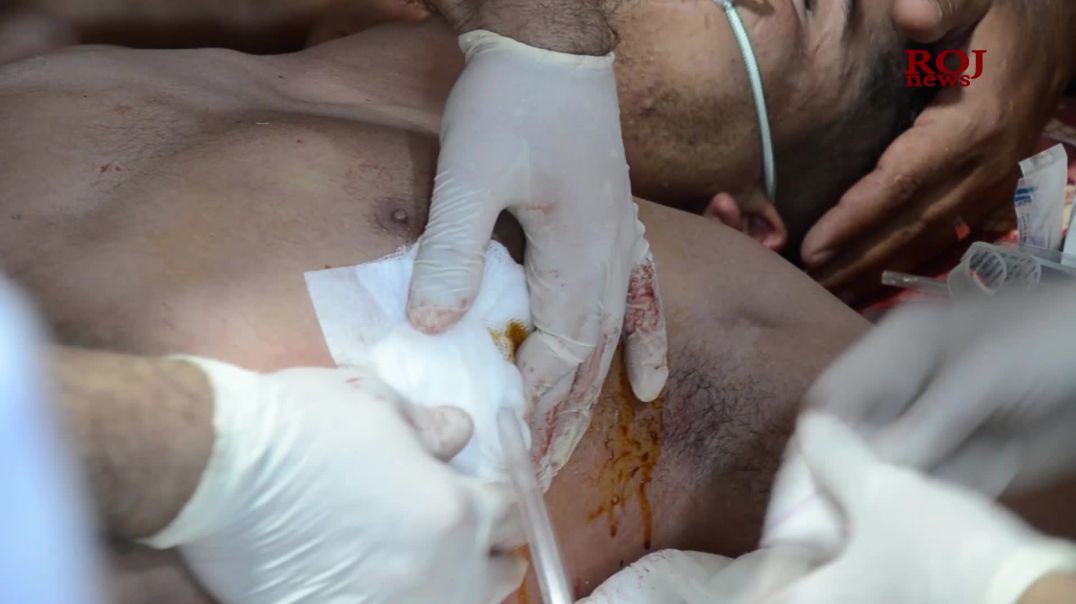 لە ئەنجامی تەقەی هێزە عێراقییەکان هاووڵاتییەکی خەڵکی مەخموور بریندار بوو