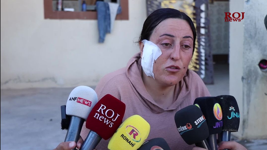 Jina di êrişa dewleta Tirk de birîndar bûyî: Dewleta Tirk êrişî min û zarokên min kir