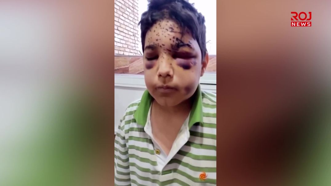 چەکدارانی ڕژێمی ئێران هێرش دەکەنە سەر منداڵێکی ١٢ ساڵ